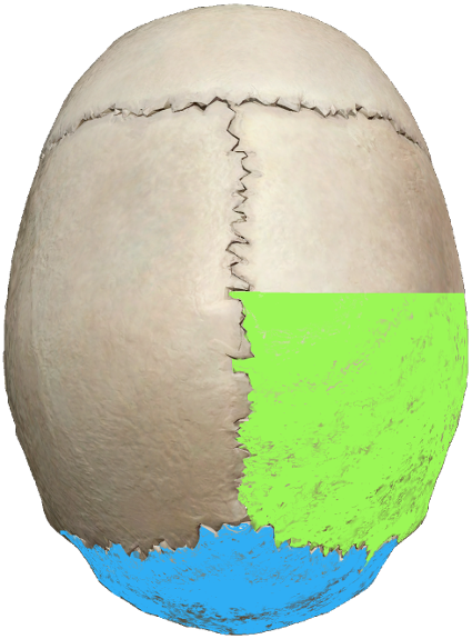 Human skull viewed from the top, lower right section highlighted green and bottom section highlighted blue